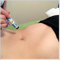 acupuncture-moxibustion